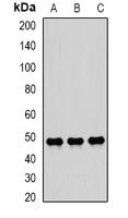 SCRN2 / Ses2 Antibody - Western blot analysis of SCRN2 expression in HeLa (A); mouse liver (B); mouse kidney (C) whole cell lysates.