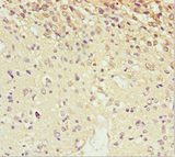 SCRN2 / Ses2 Antibody - Immunohistochemistry of paraffin-embedded human glioma cancer at dilution 1:100