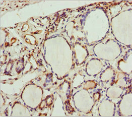 SCRN2 / Ses2 Antibody - Immunohistochemistry of paraffin-embedded human thyroid tissue at dilution 1:100