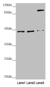 SCRN2 / Ses2 Antibody - Western blot All Lanes: SCRN2 antibody at 3.61 ug/ml Lane 1: Hela whole cell lysate Lane 2: A375 whole cell lysate Lane 3: HepG-2 whole cell lysate Secondary Goat polyclonal to rabbit IgG at 1/10000 dilution Predicted band size: 47,42 kDa Observed band size: 47,100 kDa