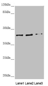 SCRN2 / Ses2 Antibody - Western blot All lanes: SCRN2 antibody at 3.61µg/ml Lane 1: Hela whole cell lysate Lane 2: A375 whole cell lysate Lane 3: HepG2 whole cell lysate Secondary Goat polyclonal to rabbit IgG at 1/10000 dilution Predicted band size: 47, 42 kDa Observed band size: 42 kDa