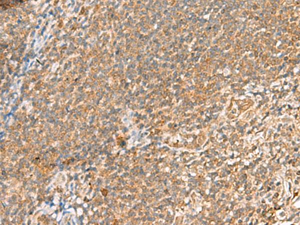 SCRN2 / Ses2 Antibody - Immunohistochemistry of paraffin-embedded Human tonsil tissue  using SCRN2 Polyclonal Antibody at dilution of 1:60(×200)