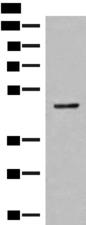 SCRN2 / Ses2 Antibody - Western blot analysis of Mouse small intestines tissue lysate  using SCRN2 Polyclonal Antibody at dilution of 1:400