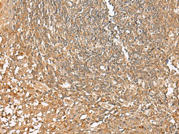 SCRN2 / Ses2 Antibody - Immunohistochemistry of paraffin-embedded Human tonsil tissue  using SCRN2 Polyclonal Antibody at dilution of 1:50(×200)