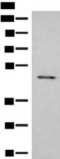 SCRN2 / Ses2 Antibody - Western blot analysis of Mouse small intestines tissue lysate  using SCRN2 Polyclonal Antibody at dilution of 1:350