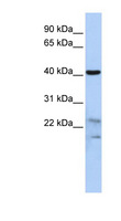 SCRN2 / Ses2 Antibody - SCRN2 antibody Western blot of HepG2 cell lysate. This image was taken for the unconjugated form of this product. Other forms have not been tested.