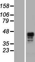 SCRN2 / Ses2 Protein - Western validation with an anti-DDK antibody * L: Control HEK293 lysate R: Over-expression lysate