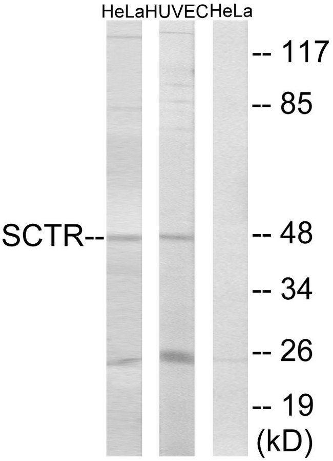 SCTR / SR / Secretin Receptor Antibody - Western blot analysis of lysates from HeLa and HUVEC cells, using SCTR Antibody. The lane on the right is blocked with the synthesized peptide.