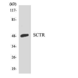 SCTR / SR / Secretin Receptor Antibody - Western blot analysis of the lysates from HeLa cells using SCTR antibody.