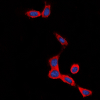 SCTR / SR / Secretin Receptor Antibody - Immunofluorescent analysis of Secretin Receptor staining in SHSY5Y cells. Formalin-fixed cells were permeabilized with 0.1% Triton X-100 in TBS for 5-10 minutes and blocked with 3% BSA-PBS for 30 minutes at room temperature. Cells were probed with the primary antibody in 3% BSA-PBS and incubated overnight at 4 deg C in a humidified chamber. Cells were washed with PBST and incubated with a DyLight 594-conjugated secondary antibody (red) in PBS at room temperature in the dark. DAPI was used to stain the cell nuclei (blue).