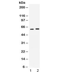 SCTR / SR / Secretin Receptor Antibody - Western blot testing of 1) rat kidney and 2) human SKOV3 lysate with SCTR antibody at 0.5ug/ml. Expected molecular weight: 50-64 kDa depending on glycosylation level.