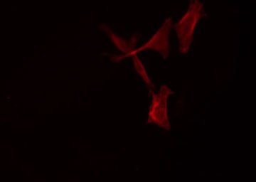 SCTR / SR / Secretin Receptor Antibody - Staining HeLa cells by IF/ICC. The samples were fixed with PFA and permeabilized in 0.1% Triton X-100, then blocked in 10% serum for 45 min at 25°C. The primary antibody was diluted at 1:200 and incubated with the sample for 1 hour at 37°C. An Alexa Fluor 594 conjugated goat anti-rabbit IgG (H+L) antibody, diluted at 1/600, was used as secondary antibody.