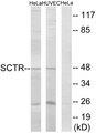 SCTR / SR / Secretin Receptor Antibody - Western blot analysis of extracts from HeLa cells and HUVEC cells, using SCTR antibody.