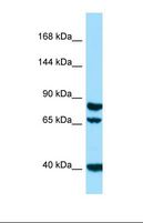 SCUBE1 Antibody - Western blot of Human HepG2. SCUBE1 antibody dilution 1.0 ug/ml.  This image was taken for the unconjugated form of this product. Other forms have not been tested.
