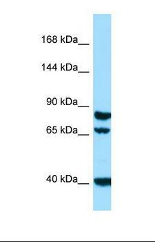 SCUBE1 Antibody - Western blot of Human HepG2. SCUBE1 antibody dilution 1.0 ug/ml.  This image was taken for the unconjugated form of this product. Other forms have not been tested.