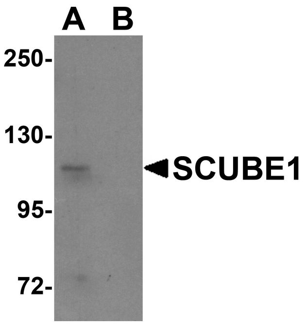 SCUBE1 Antibody - Western blot analysis of SCUBE1 in Daudi cell lysate with SCUBE1 antibody at 1 ug/ml in (A) the absence and (B) the presence of blocking peptide.
