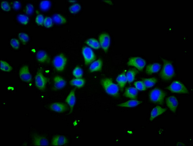 SCUBE1 Antibody - Immunofluorescence staining of Hela cells diluted at 1:133, counter-stained with DAPI. The cells were fixed in 4% formaldehyde, permeabilized using 0.2% Triton X-100 and blocked in 10% normal Goat Serum. The cells were then incubated with the antibody overnight at 4°C.The Secondary antibody was Alexa Fluor 488-congugated AffiniPure Goat Anti-Rabbit IgG (H+L).