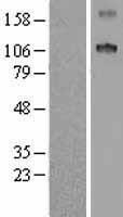 SCUBE1 Protein - Western validation with an anti-DDK antibody * L: Control HEK293 lysate R: Over-expression lysate
