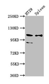SCUBE2 Antibody - Western Blot Positive WB detected in: HT29 whole cell lysate, Rat spleen tissue All lanes: SCUBE2 antibody at 8.7µg/ml Secondary Goat polyclonal to rabbit IgG at 1/50000 dilution Predicted band size: 110, 107, 89 kDa Observed band size: 110, 89 kDa
