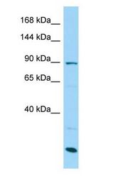 SCUBE3 Antibody - SCUBE3 antibody Western Blot of MCF7.  This image was taken for the unconjugated form of this product. Other forms have not been tested.