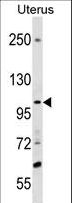 SCUBE3 Antibody - SCUBE3 Antibody western blot of Uterus tissue lysates (35 ug/lane). The SCUBE3 antibody detected the SCUBE3 protein (arrow).