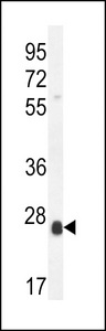 SCX Antibody - SCXA Antibody western blot of mouse cerebellum tissue lysates (35 ug/lane). The SCXA antibody detected the SCXA protein (arrow).