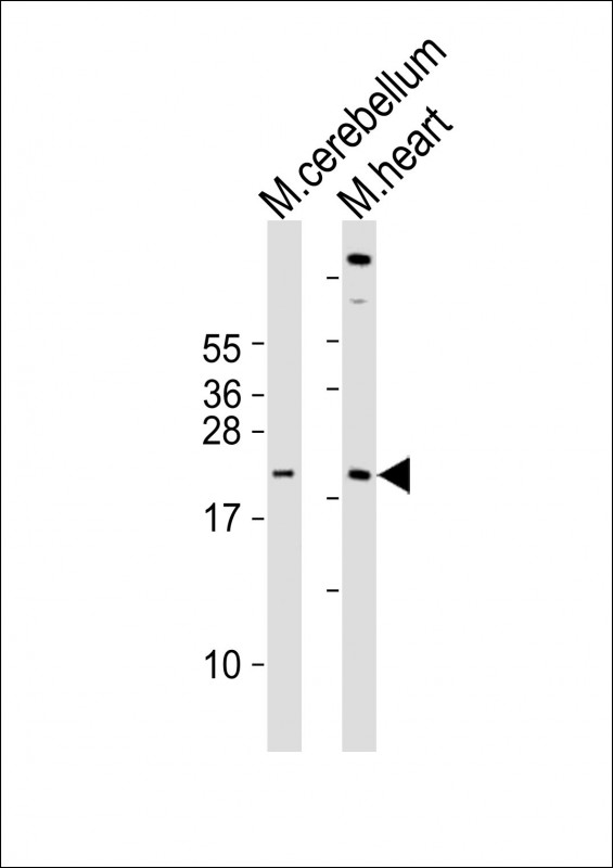 SCX Antibody - All lanes : Anti-Scx Antibody at 1:2000 dilution Lane 1: mouse cerebellum lysates Lane 2: mouse heart lysates Lysates/proteins at 20 ug per lane. Secondary Goat Anti-Rabbit IgG, (H+L), Peroxidase conjugated at 1/10000 dilution Predicted band size : 22 kDa Blocking/Dilution buffer: 5% NFDM/TBST.