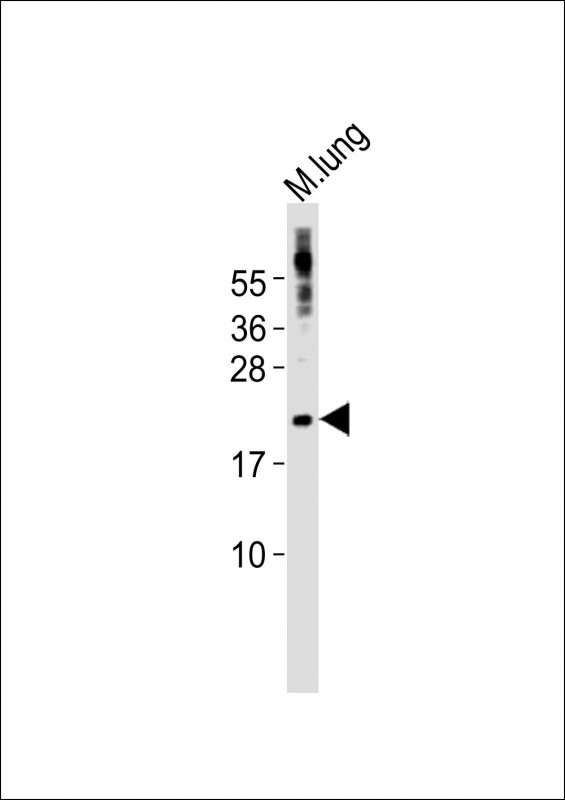 SCX Antibody - Anti-Scx Antibody at 1:1000 dilution + mouse lung lysates Lysates/proteins at 20 ug per lane. Secondary Goat Anti-Rabbit IgG, (H+L), Peroxidase conjugated at 1/10000 dilution Predicted band size : 22 kDa Blocking/Dilution buffer: 5% NFDM/TBST.