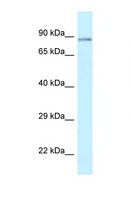 SCYL1 / NTKL Antibody - SCYL1 antibody Western blot of Fetal Brain lysate. Antibody concentration 1 ug/ml.  This image was taken for the unconjugated form of this product. Other forms have not been tested.