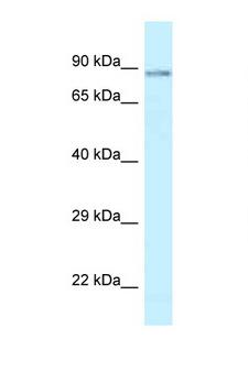 SCYL1 / NTKL Antibody - SCYL1 antibody Western blot of Fetal Brain lysate. Antibody concentration 1 ug/ml.  This image was taken for the unconjugated form of this product. Other forms have not been tested.