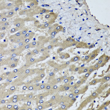 SCYL1 / NTKL Antibody - Immunohistochemistry of paraffin-embedded human liver injury tissue.