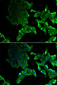 SCYL1 / NTKL Antibody - Immunofluorescence analysis of MCF-7 cells.
