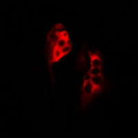 SCYL1 / NTKL Antibody - Immunofluorescent analysis of SCYL1 staining in MCF7 cells. Formalin-fixed cells were permeabilized with 0.1% Triton X-100 in TBS for 5-10 minutes and blocked with 3% BSA-PBS for 30 minutes at room temperature. Cells were probed with the primary antibody in 3% BSA-PBS and incubated overnight at 4 deg C in a humidified chamber. Cells were washed with PBST and incubated with a DyLight 594-conjugated secondary antibody (red) in PBS at room temperature in the dark.