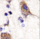SCYL2 Antibody - Formalin-fixed and paraffin-embedded human brain tissue reacted with SCYL2 , which was peroxidase-conjugated to the secondary antibody, followed by DAB staining. This data demonstrates the use of this antibody for immunohistochemistry; clinical relevance has not been evaluated.