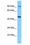 SCYL2 Antibody - SCYL2 antibody Western Blot of 293T. Antibody dilution: 1 ug/ml.  This image was taken for the unconjugated form of this product. Other forms have not been tested.