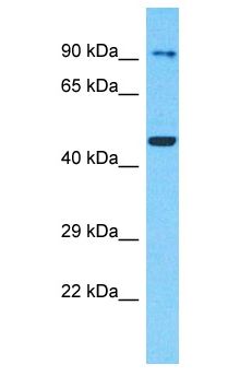SCYL2 Antibody - SCYL2 antibody Western Blot of 293T. Antibody dilution: 1 ug/ml.  This image was taken for the unconjugated form of this product. Other forms have not been tested.