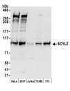 SCYL2 Antibody - Detection of human and mouse SCYL2 by western blot. Samples: Whole cell lysate (50 µg) from HeLa, HEK293T, Jurkat, mouse TCMK-1, and mouse NIH 3T3 cells prepared using NETN lysis buffer. Antibody: Affinity purified rabbit anti-SCYL2 antibody used for WB at 0.04 µg/ml. Detection: Chemiluminescence with an exposure time of 30 seconds.