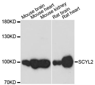 SCYL2 Antibody - Western blot analysis of extracts of various cell lines, using SCYL2 antibody at 1:3000 dilution. The secondary antibody used was an HRP Goat Anti-Rabbit IgG (H+L) at 1:10000 dilution. Lysates were loaded 25ug per lane and 3% nonfat dry milk in TBST was used for blocking. An ECL Kit was used for detection and the exposure time was 30s.