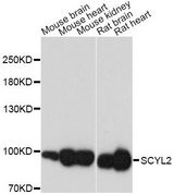 SCYL2 Antibody - Western blot analysis of extracts of various cell lines, using SCYL2 antibody at 1:3000 dilution. The secondary antibody used was an HRP Goat Anti-Rabbit IgG (H+L) at 1:10000 dilution. Lysates were loaded 25ug per lane and 3% nonfat dry milk in TBST was used for blocking. An ECL Kit was used for detection and the exposure time was 1s.