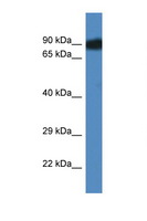 SCYL3 Antibody - SCYL3 antibody Western blot of Mouse Liver lysate. Antibody concentration 1 ug/ml. This image was taken for the unconjugated form of this product. Other forms have not been tested.