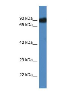 SCYL3 Antibody - SCYL3 antibody Western blot of Mouse Liver lysate. Antibody concentration 1 ug/ml. This image was taken for the unconjugated form of this product. Other forms have not been tested.