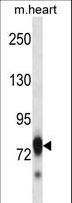 SCYL3 Antibody - Mouse Scyl3 Antibody western blot of mouse heart tissue lysates (35 ug/lane). The Scyl3 antibody detected the Scyl3 protein (arrow).