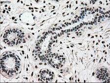 SCYL3 Antibody - IHC of paraffin-embedded breast tissue using anti-SCYL3 mouse monoclonal antibody. (Dilution 1:50).