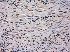SCYL3 Antibody - IHC of paraffin-embedded endometrium tissue using anti-SCYL3 mouse monoclonal antibody. (Dilution 1:50).