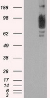 SCYL3 Antibody - HEK293T cells were transfected with the pCMV6-ENTRY control (Left lane) or pCMV6-ENTRY SCYL3 (Right lane) cDNA for 48 hrs and lysed. Equivalent amounts of cell lysates (5 ug per lane) were separated by SDS-PAGE and immunoblotted with anti-SCYL3.