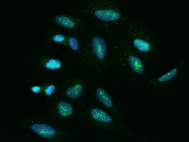 SDAD1 Antibody - Immunofluorescence staining of SDAD1 in U2OS cells. Cells were fixed with 4% PFA, permeabilzed with 0.1% Triton X-100 in PBS, blocked with 10% serum, and incubated with rabbit anti-Human SDAD1 polyclonal antibody (dilution ratio 1:200) at 4°C overnight. Then cells were stained with the Alexa Fluor 488-conjugated Goat Anti-rabbit IgG secondary antibody (green) and counterstained with DAPI (blue). Positive staining was localized to Nucleus.