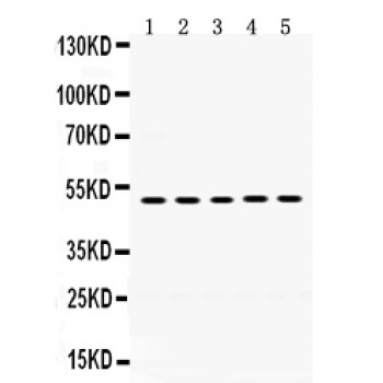 SDC1 / Syndecan 1 / CD138 Antibody - Syndecan-1 antibody Western blot. All lanes: Anti Syndecan-1 at 0.5 ug/ml. Lane 1: HT1080 Whole Cell Lysate at 40 ug. Lane 2: MCF-7 Whole Cell Lysate at 40 ug. Lane 3: 293T Whole Cell Lysate at 40 ug. Lane 4: HEPG2 Whole Cell Lysate at 40 ug. Lane 5: HELA Whole Cell Lysate at 40 ug. Predicted band size: 50 kD. Observed band size: 50 kD.