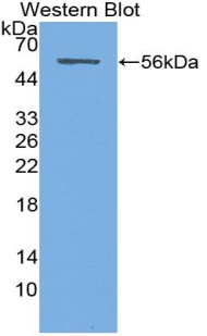 SDC1 / Syndecan 1 / CD138 Antibody - Western blot of recombinant SDC1 / Syndecan 1 / CD138.