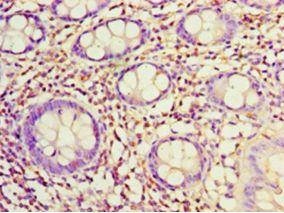 SDC1 / Syndecan 1 / CD138 Antibody - Immunohistochemistry of paraffin-embedded human rectum tissue using antibody at 1:100 dilution.  This image was taken for the unconjugated form of this product. Other forms have not been tested.