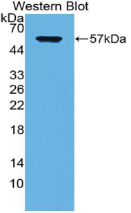 SDC1 / Syndecan 1 / CD138 Antibody - Western blot of recombinant SDC1 / Syndecan 1 / CD138.